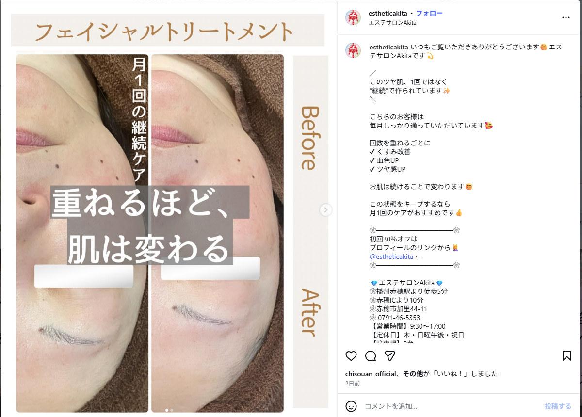 フェイシャルトリートメント ビフォーアフター