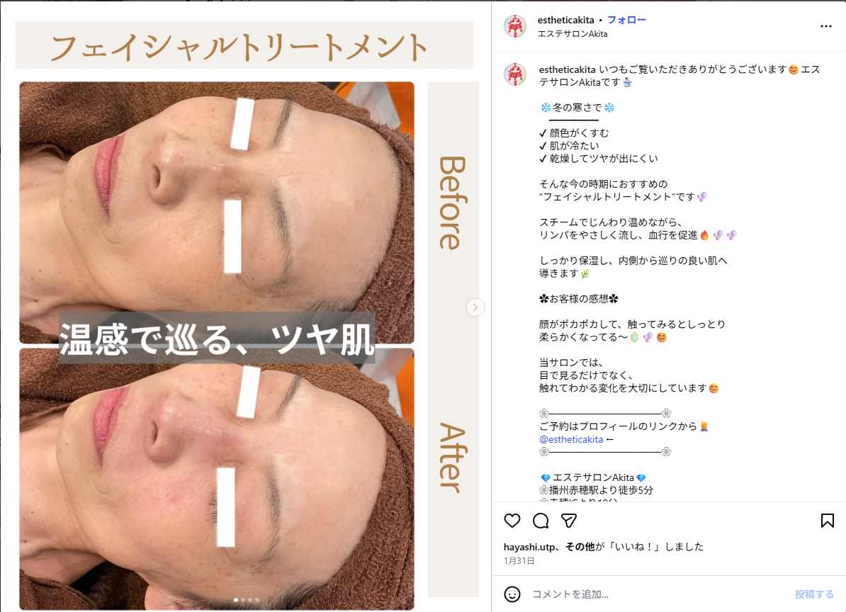フェイシャルトリートメント 冬の乾燥対策 ビフォーアフター